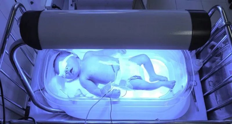 Фотолампа - безопасное лечение желтушки. — фото 2