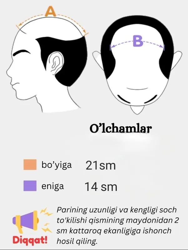 Erkaklar uchun soch protezi, soch tizimi 6
