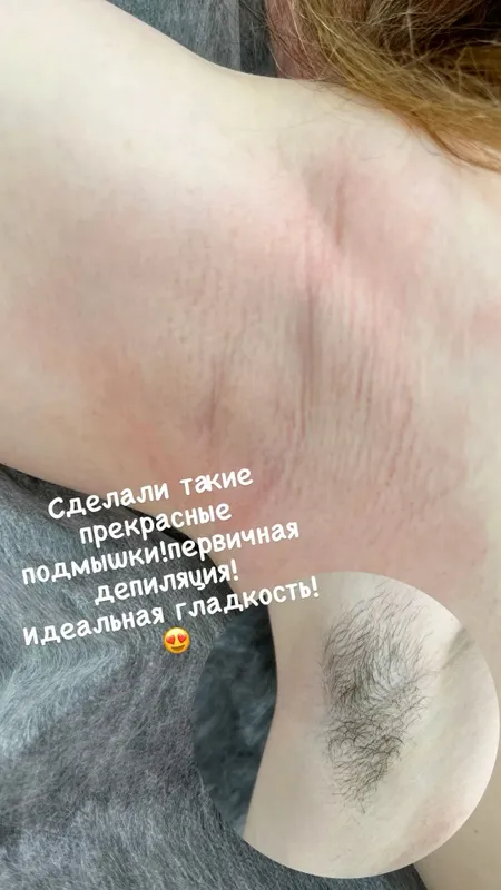 Депиляция шугаринг ламинирование ресниц и бровей Депиляция шугаринг ламинирование ресниц и бровей