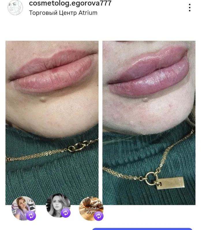 Прокалывание ушей — фото 5