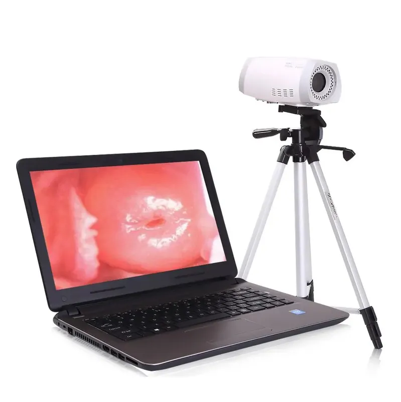 Кольпоскоп SONY CCD Color video camera 1