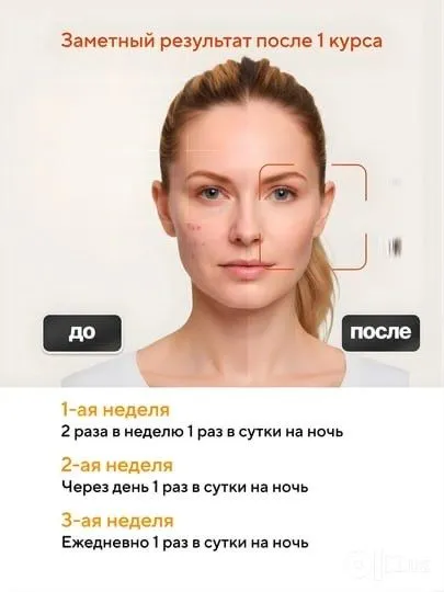 Tretinoin Cream USP 0.1 % Третиноин гель0.1% 4 Tretinoin Cream USP 0.1 % Третиноин гель0.1% 4