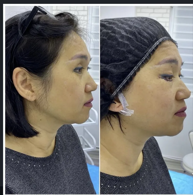 Muhabbat_cosmetolog Скидка хамма процедуралага 4