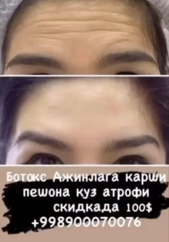 Лазер | Ботокс | Пилинги | Удаление татуажа | Косметолог — фото 7