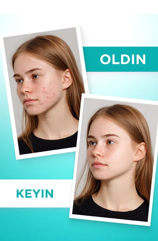 TeenSkin гель для глубокого очищения кожи 9 TeenSkin гель для глубокого очищения кожи 9
