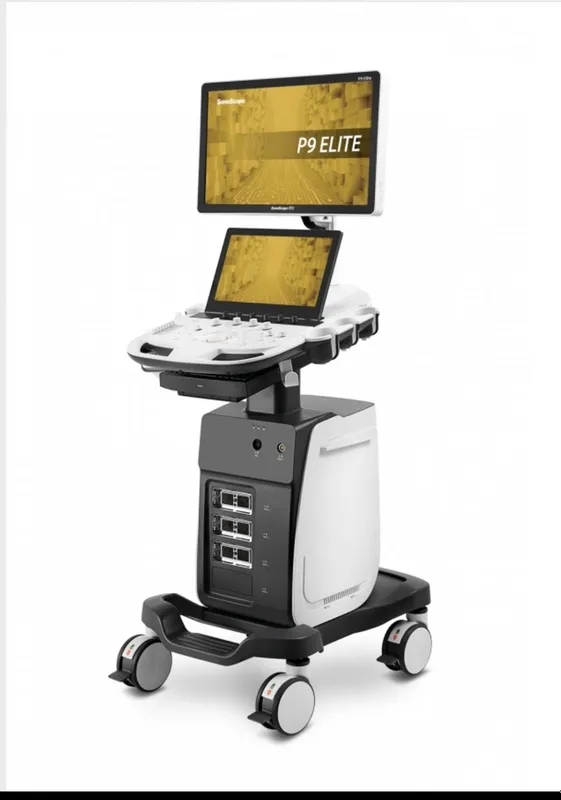 Узи аппарат.SonoScape P9 Elite
