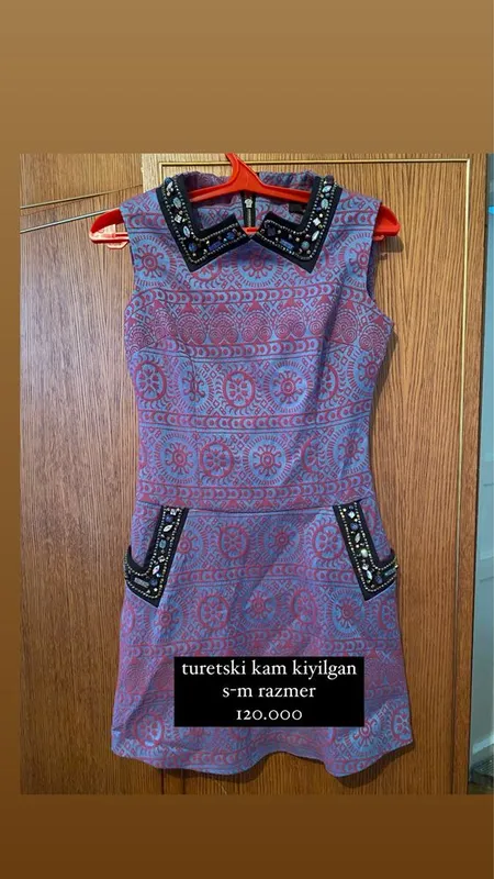 ko’ynela xolati zo’r xammasi kam kiyilgan — фото 1