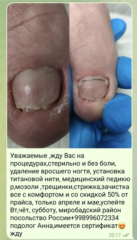 Педикюр для всех — фото 3