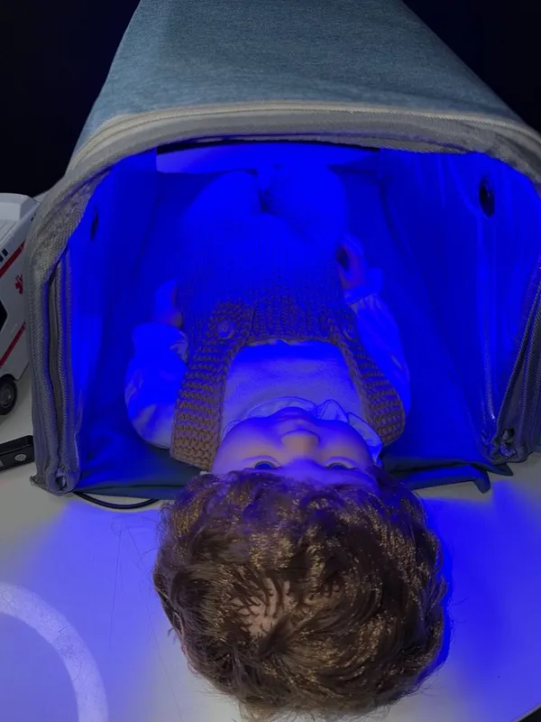 Фотолампа от желтухи 6 Фотолампа от желтухи 6
