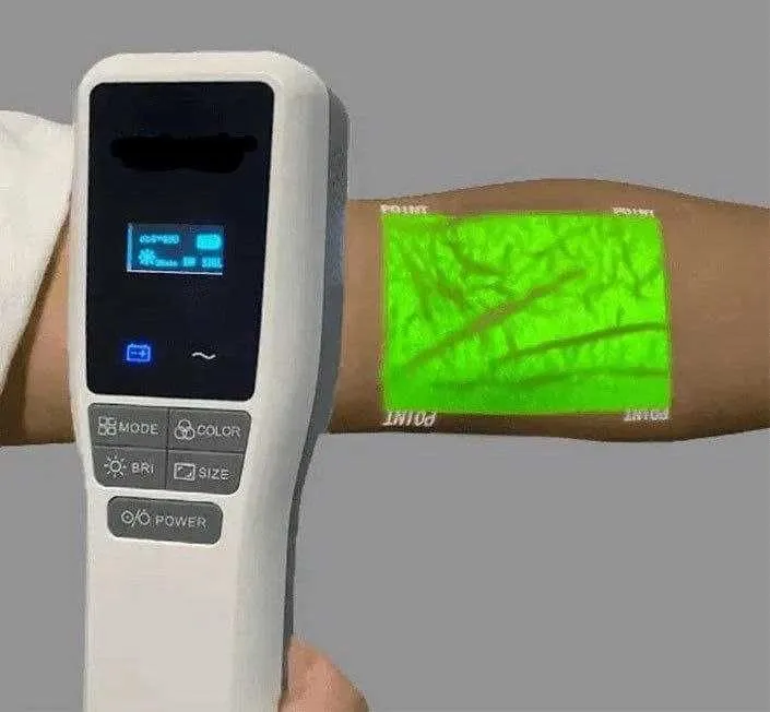 Venovizer | веновизор | Vein Finder top1 — фото 1