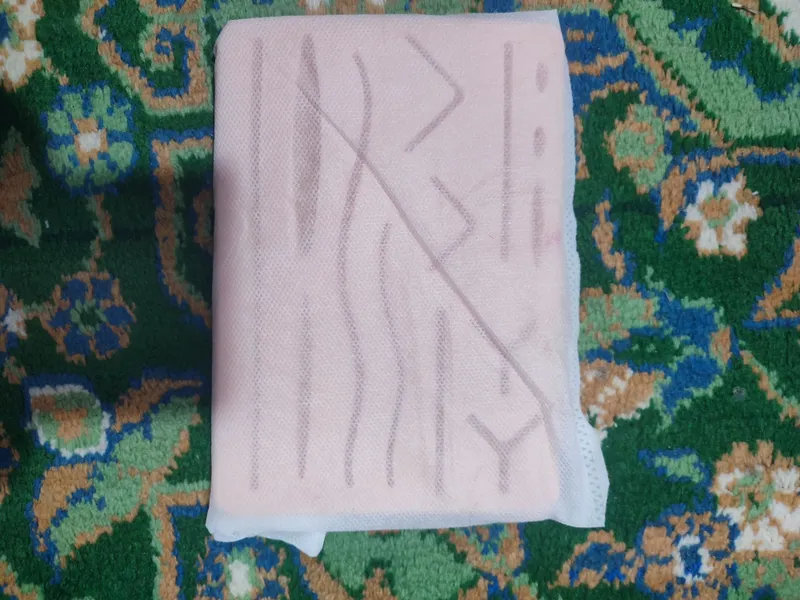 Jarrohlik to‘plami 3