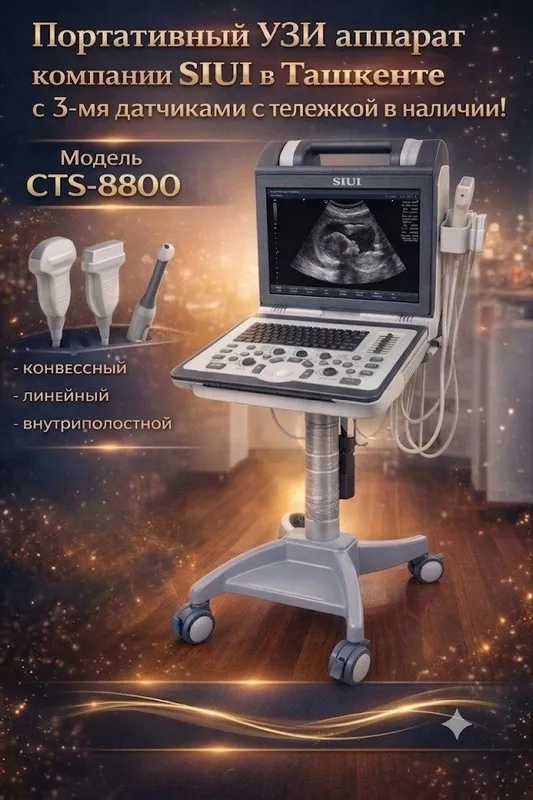 УЗИ аппарат