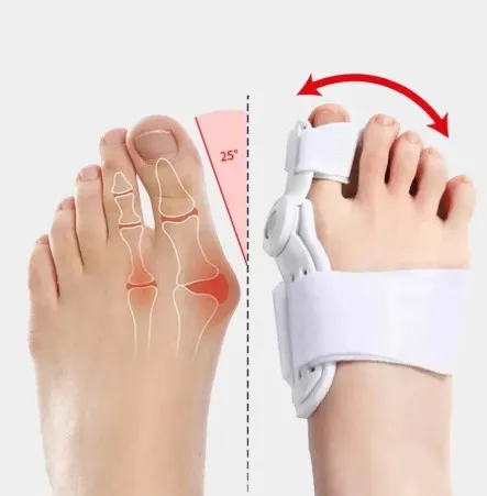 Oyoq uchun fiksator Hallux Valgus 2 Oyoq uchun fiksator Hallux Valgus 2