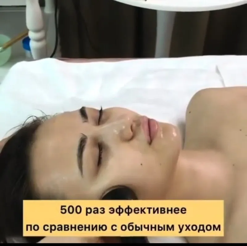 Yuz va tana uchun kosmetologik apparat — фото 6