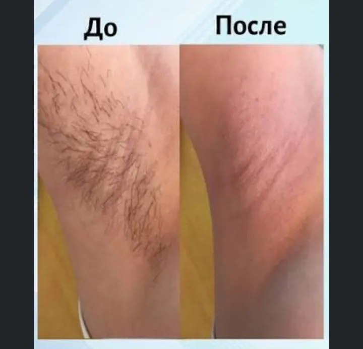 салон мужской депиляции мужской Педекюр салон мужской депиляции мужской Педекюр
