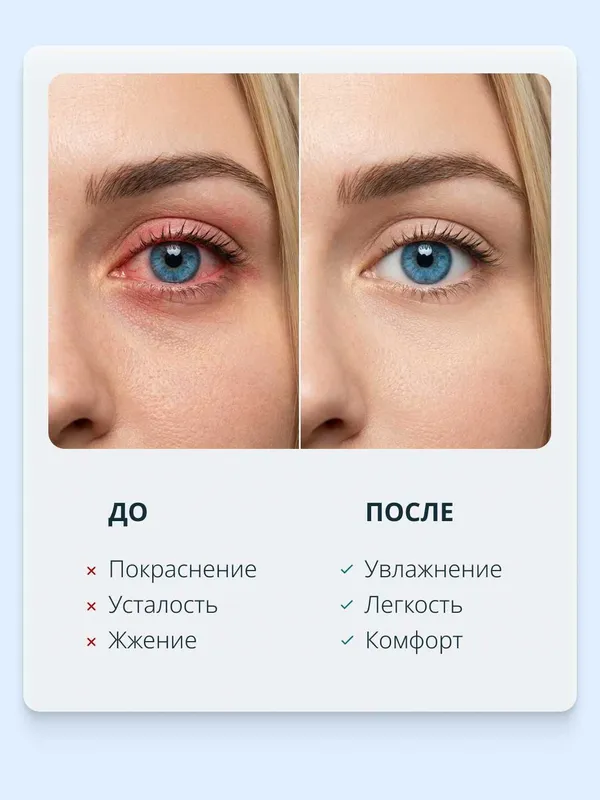 Капли глазные RELINS увлажняющие с L-карнитином и L-ментолом, 10 мл. 4 Капли глазные RELINS увлажняющие с L-карнитином и L-ментолом, 10 мл. 4