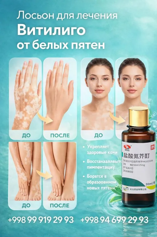 Лосьон от витилиго. Vitiligo lasyon 4