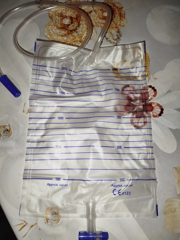 Yangi siydik qopchalari - urine bag 2000 ml — фото 1