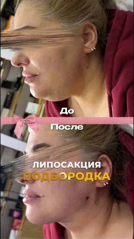 Услуги косметолога 2