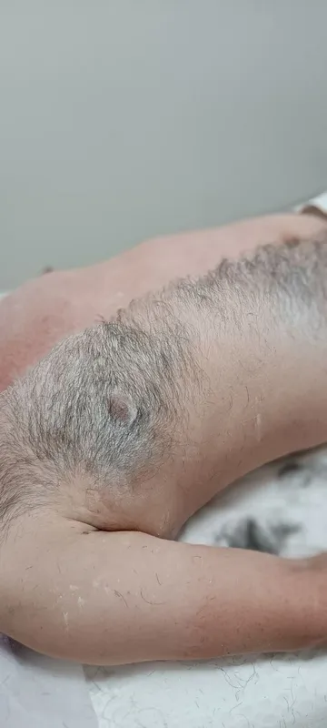 Депиляция мужчинам 4 Депиляция мужчинам 4