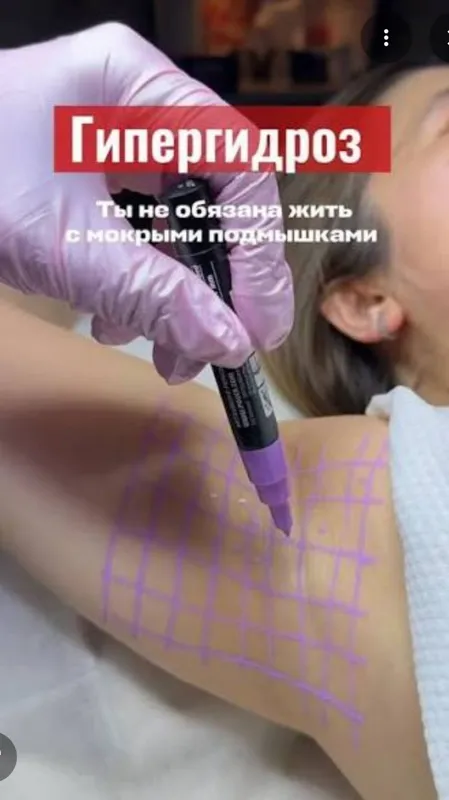 Косметолог лазерный лифтинг ,акне чистка лица мезо ,ботокс и прочии . 4