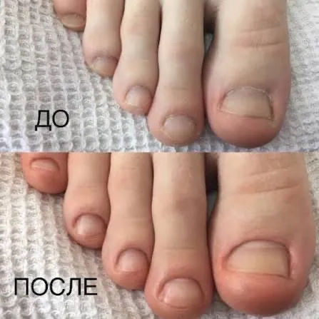 Маникюр и педикюр с выездом на дом — фото 1