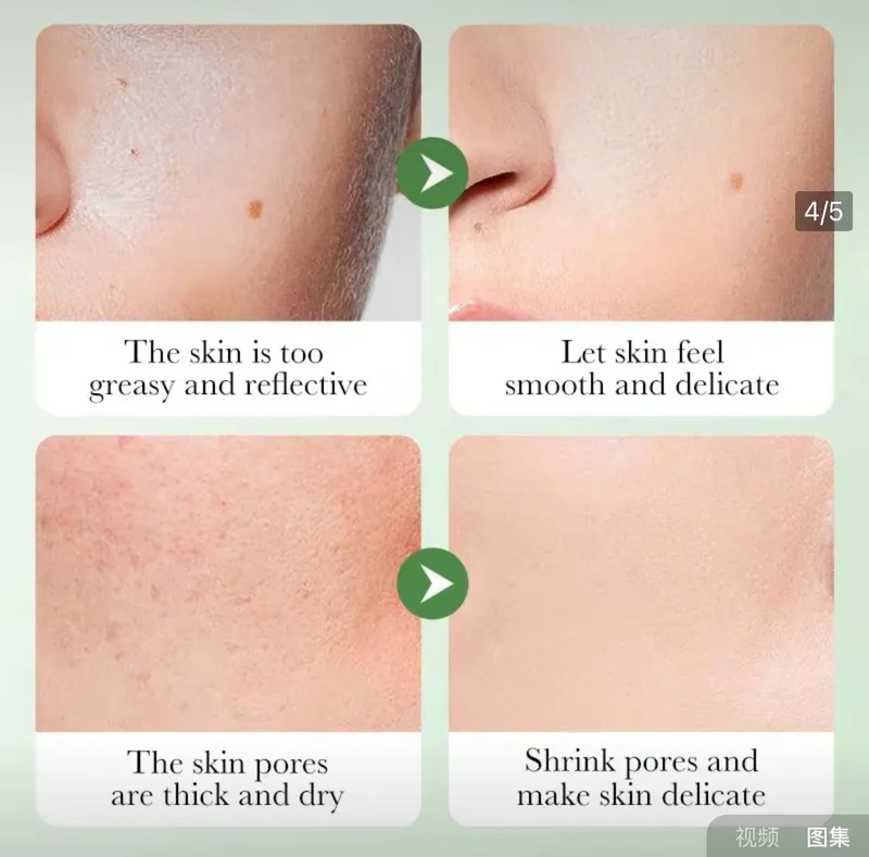 Подарочный набор с центеллой азиатской Bioaqua Centella Asiatica Soothing Repair Six-piece — фото 1