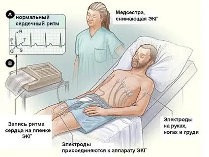 ЭКГ услуга на дому 2
