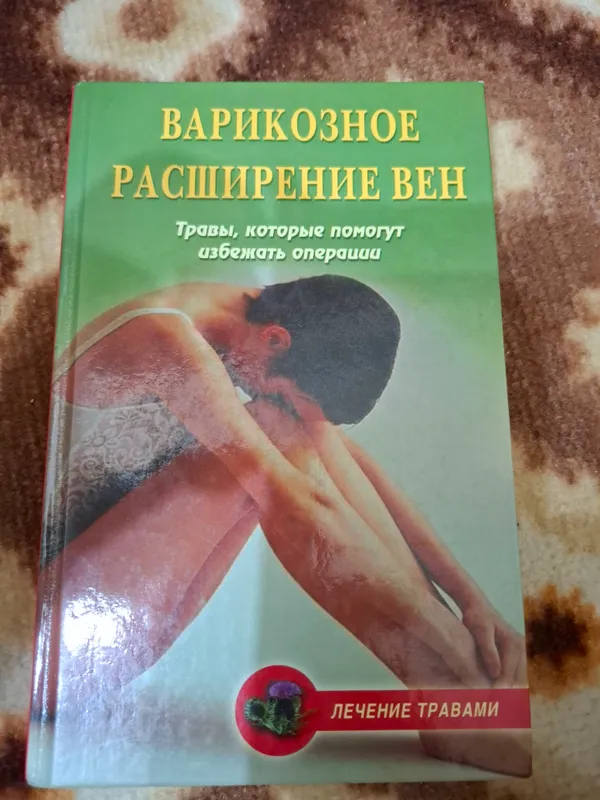 Варикозное расширение вен.Травы.