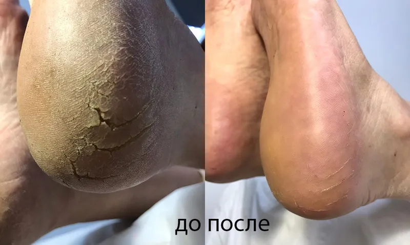 Маникюр и педикюр с выездом на дом — фото 3