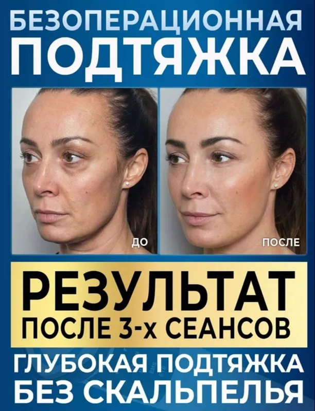 Микротоковый массажер, для лица, от морщин, отеков 3 Микротоковый массажер, для лица, от морщин, отеков 3