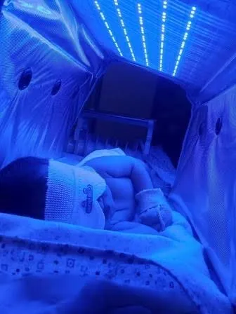 Фотолампа Fotolampa Фотолампа от желтухи за день 40.000 — фото 1